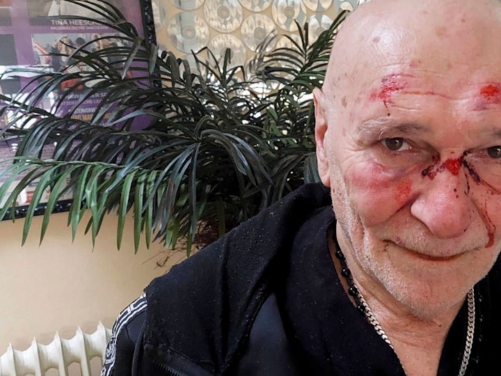 Der Schlagersänger Peter Sebastian veröffentlichte nach dem Überfall ein Foto, das die bei dem Angriff erlittenen Verletzungen in seinem Gesicht zeigt.