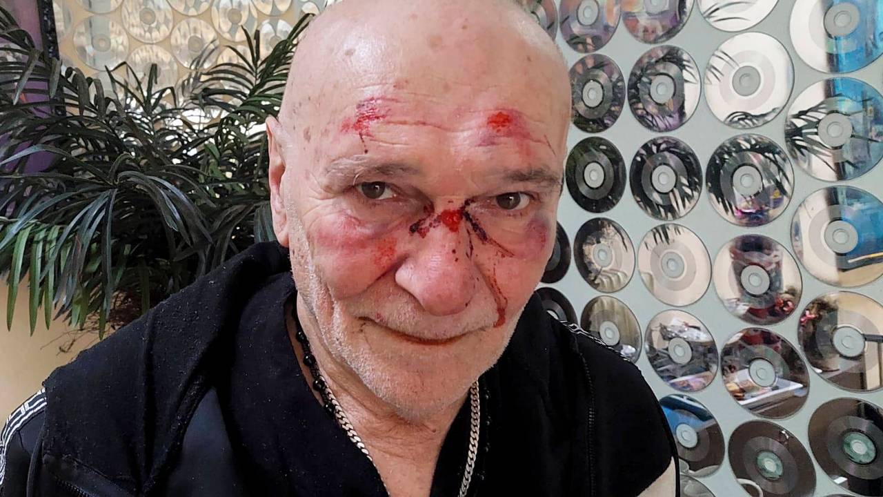 Der Schlagersänger Peter Sebastian veröffentlichte nach dem Überfall ein Foto, das die bei dem Angriff erlittenen Verletzungen in seinem Gesicht zeigt.