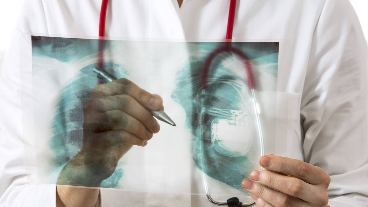 Ärztin betrachtet Röntgenbild mit Herzschrittmacher