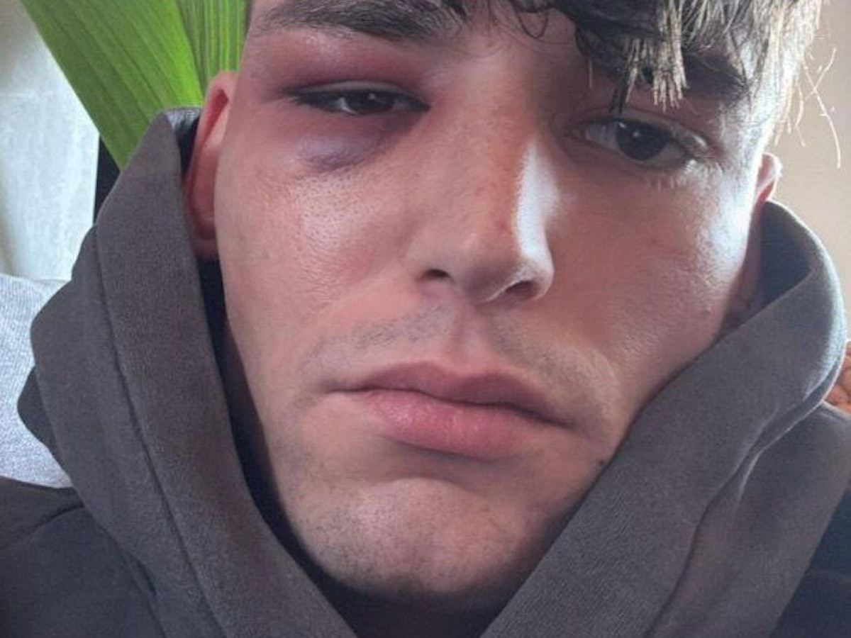 Drei Männer haben Pascal Kaiser in seinem Garten angegriffen.