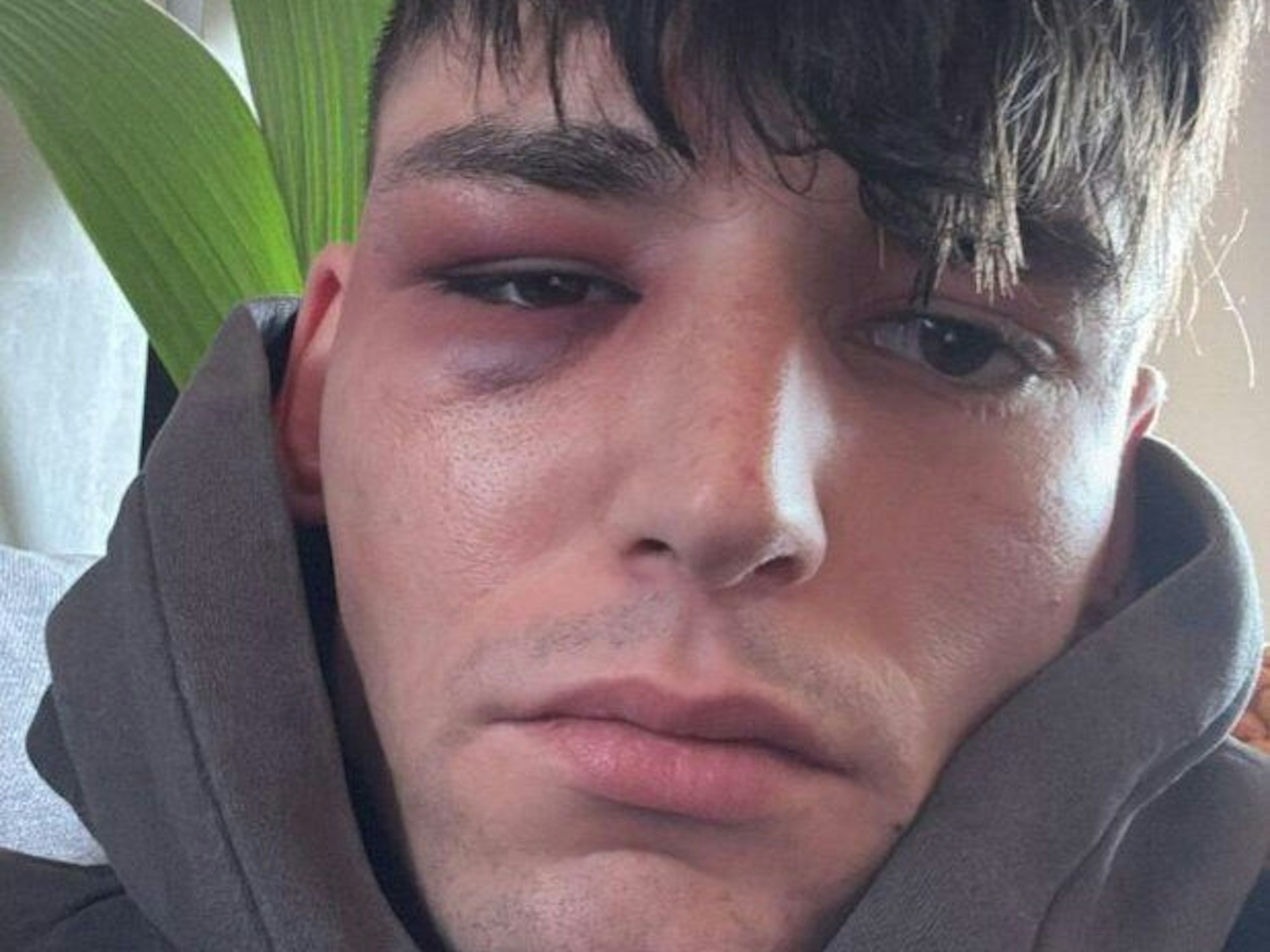 Drei Männer haben Pascal Kaiser in seinem Garten angegriffen.