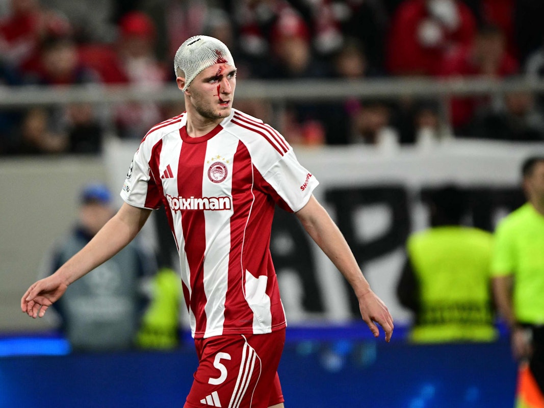 Lorenzo Pirola blutet im Spiel von Piräus gegen Leverkusen in der Champions League am Kopf.