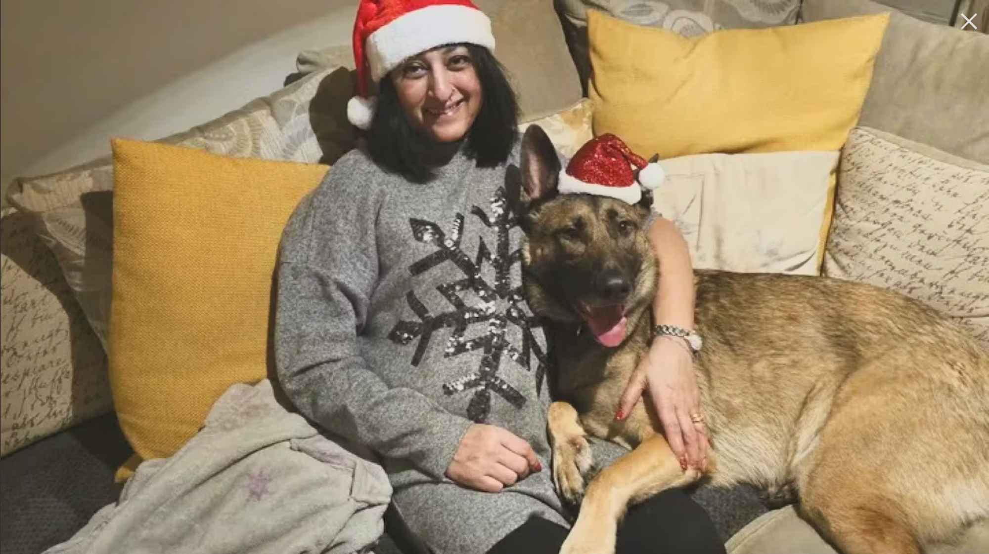 Manjit Sangha erlitt nach dem Spielen mit ihrem Hund eine Sepsis, vermutlich ausgelöst durch den Speichel des Tieres.