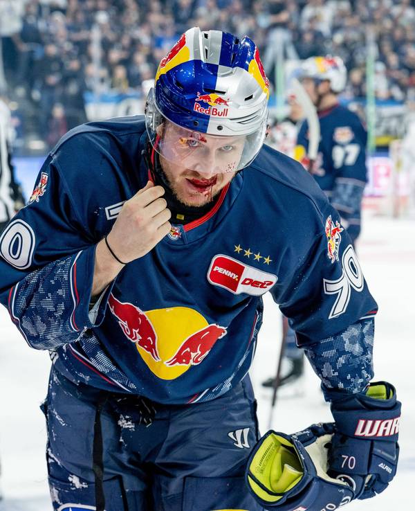 Maximilian Daubner wurde beim Spiel der Kölner Haie beim EHC Red Bull München vom Puck im Gesicht getroffen.