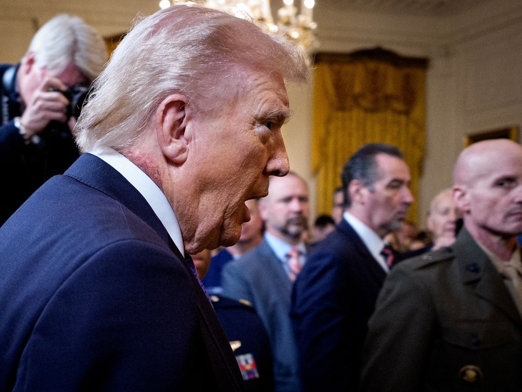 Die Rötung am Hals von US-Präsident Donald Trump sorgt derzeit für wilde Spekulationen. (Bild: 2026 Getty Images/Andrew Harnik)