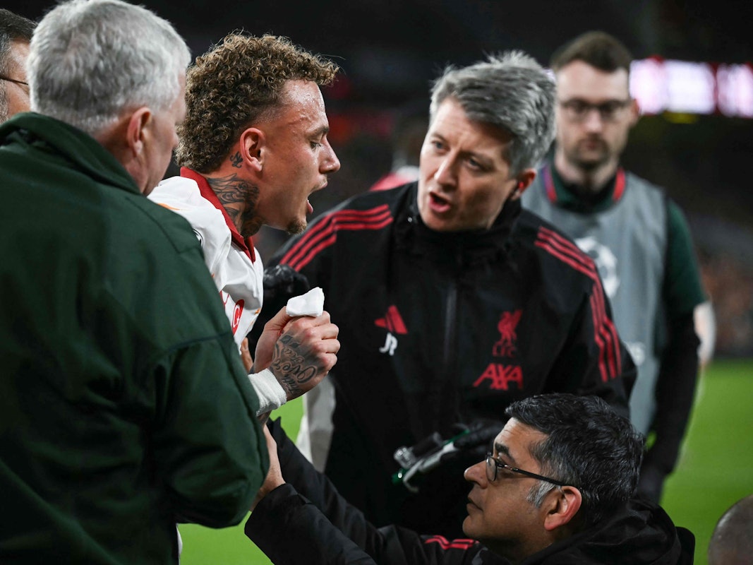 Noa Lang (3.v.l.) hat Schmerzen wegen seiner Verletzung am Finger.