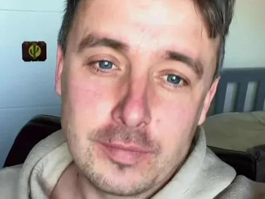 Steven Hamill verlor seinen halben Penis nach einer Krebsdiagnose.