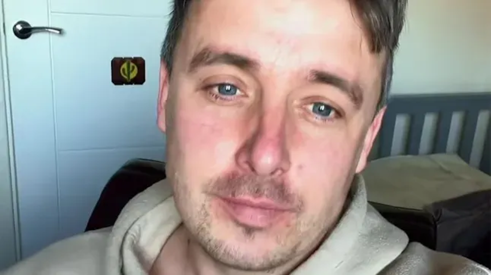 Steven Hamill verlor seinen halben Penis nach einer Krebsdiagnose.