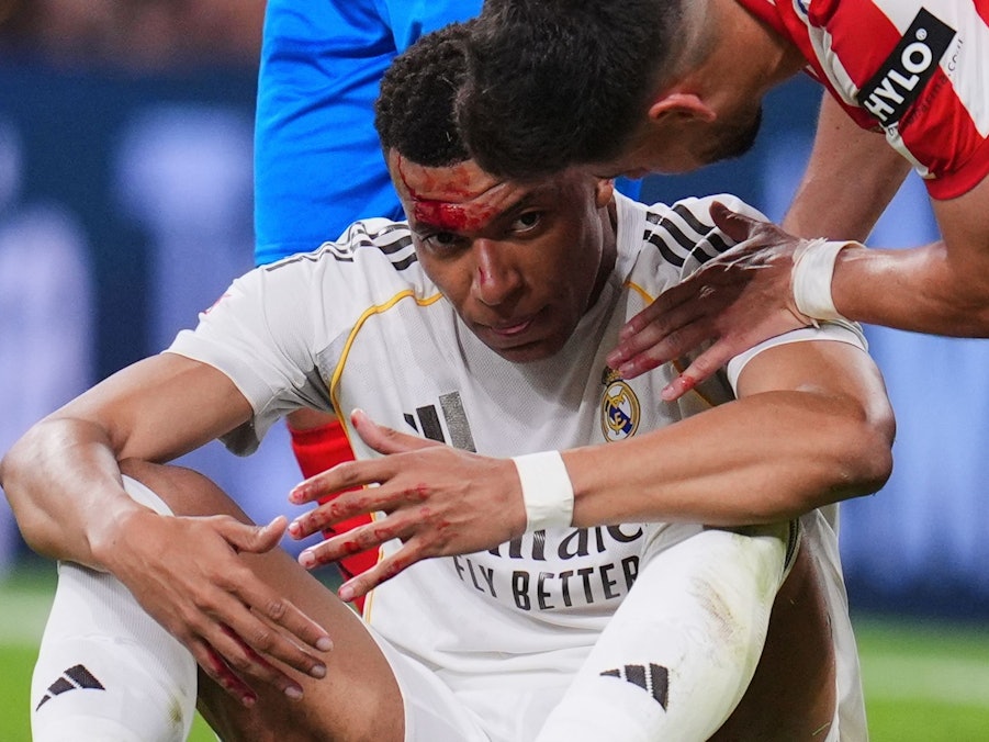 Real Madrid - FC Girona