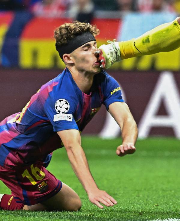 Barcelonas Fermin Lopez wurde von Atletico-Keeper Juan Musso böse mit den Stollen im Gesicht getroffen.