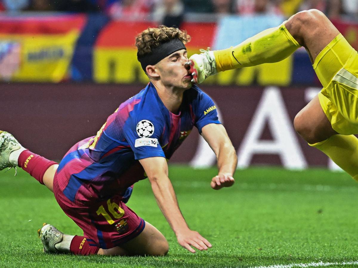 Barcelonas Fermin Lopez wurde von Atletico-Keeper Juan Musso böse mit den Stollen im Gesicht getroffen.