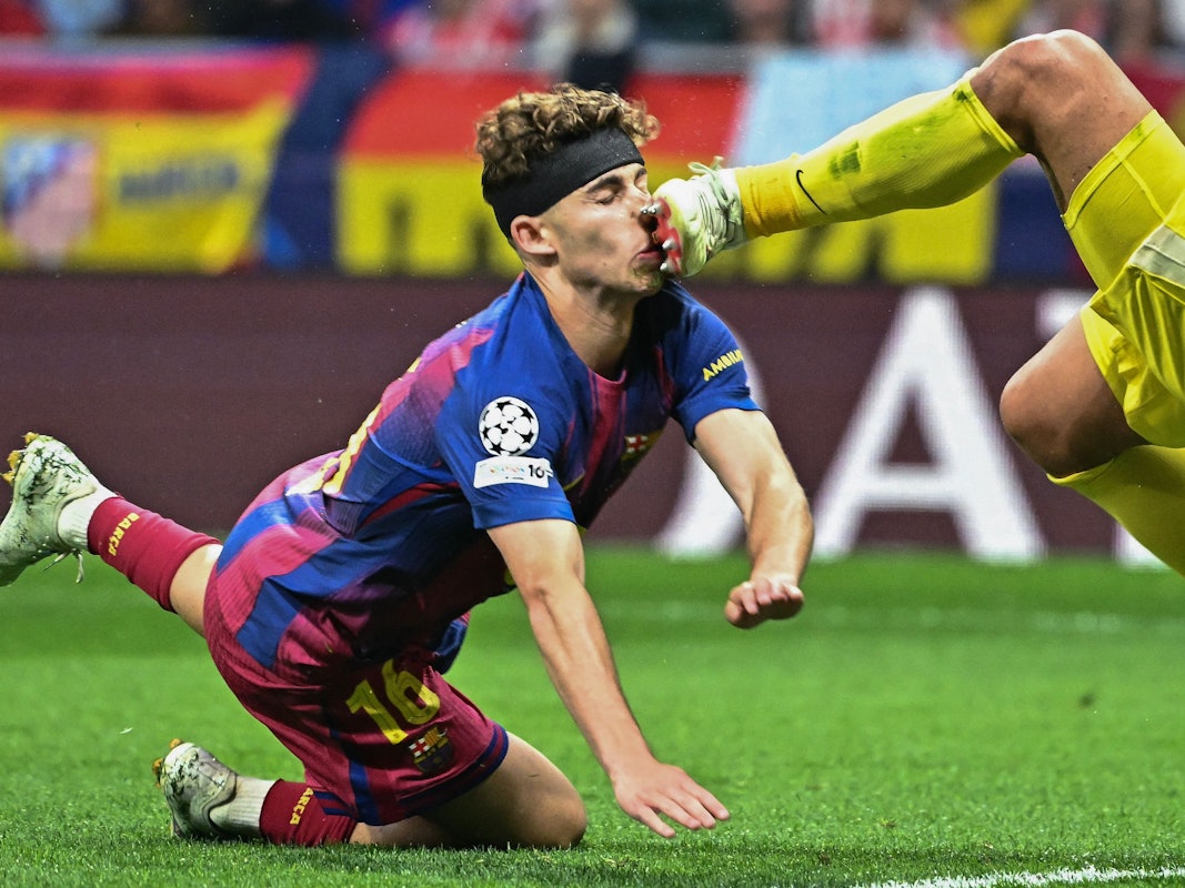 Barcelonas Fermin Lopez wurde von Atletico-Keeper Juan Musso böse mit den Stollen im Gesicht getroffen.