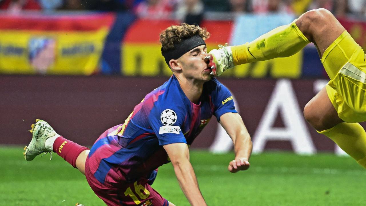 Barcelonas Fermin Lopez wurde von Atletico-Keeper Juan Musso böse mit den Stollen im Gesicht getroffen.