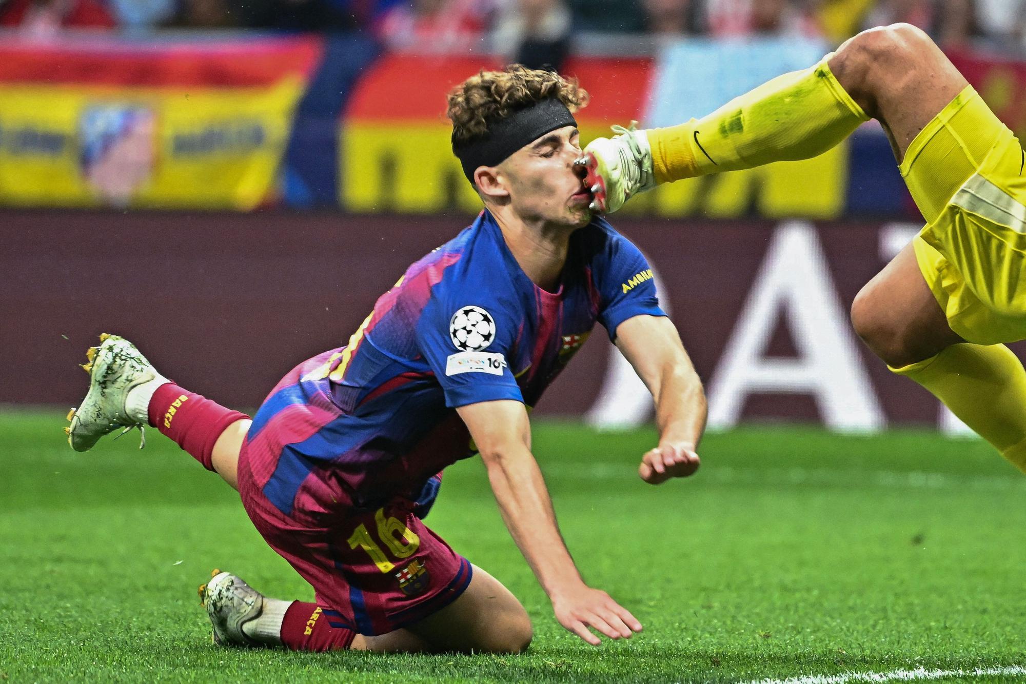 Barcelonas Fermin Lopez wurde von Atletico-Keeper Juan Musso böse mit den Stollen im Gesicht getroffen.