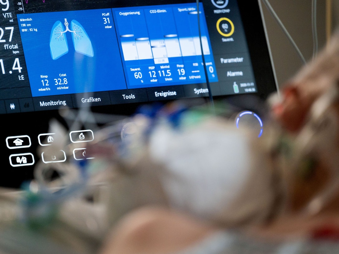 Ein Patient, der im künstlichen Koma liegt und beatmet wird, liegt in einem Bett.