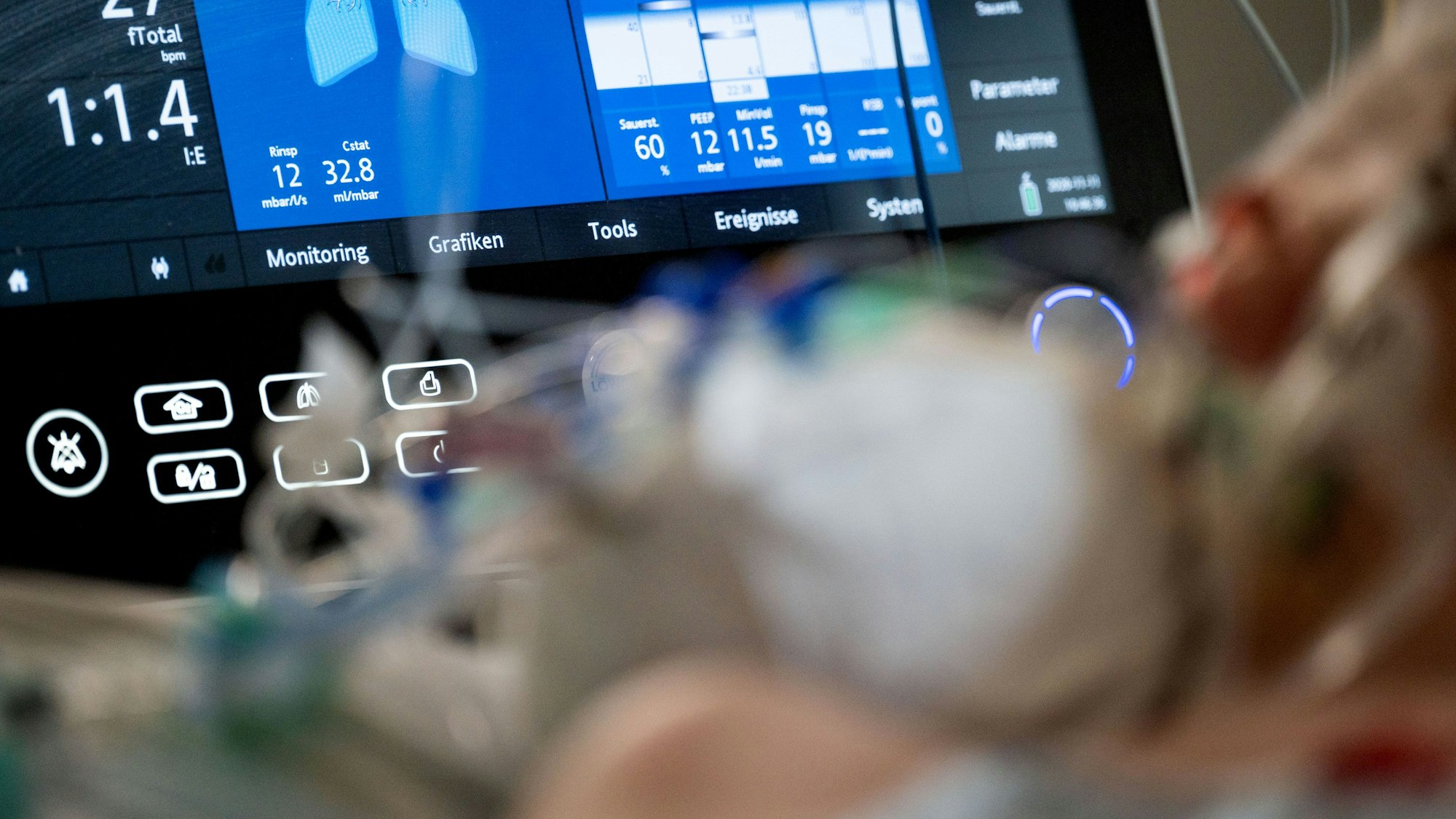 Ein Patient, der im künstlichen Koma liegt und beatmet wird, liegt in einem Bett.