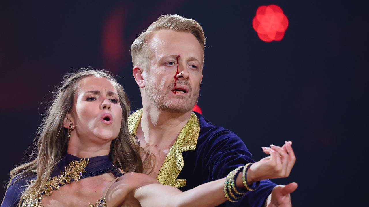 Ross Antony wurde vom Ellenbogen seiner Partnerin Mariia Maksina getroffen. Antony zog sich dabei eine blutende Wunde zu.