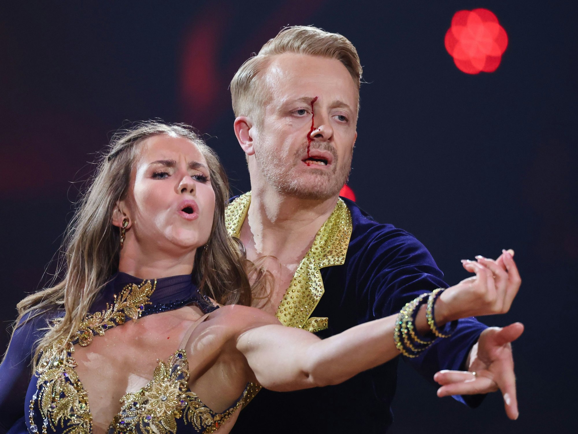 Ross Antony wurde vom Ellenbogen seiner Partnerin Mariia Maksina getroffen. Antony zog sich dabei eine blutende Wunde zu.