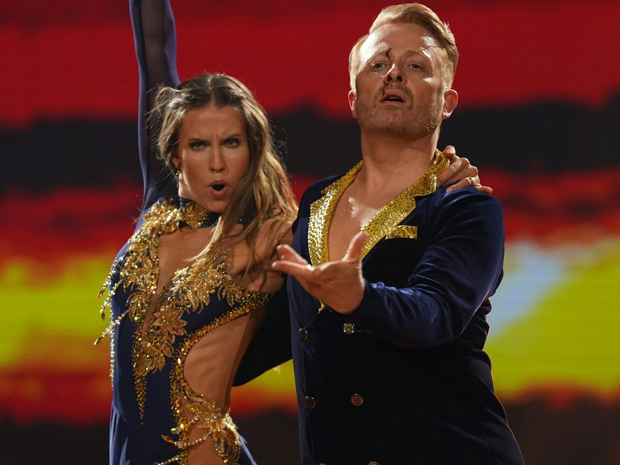 Tanzpartnerin Mariia Maksina trifft Sänger Ross Antony bei der Rumba zu „Human Nature“ an der Stirn. Moderator Daniel Hartwich: „Es sollte doch Herzblut sein, nicht Stirnblut“ (Bild: RTL / Stefan Gregorowius)