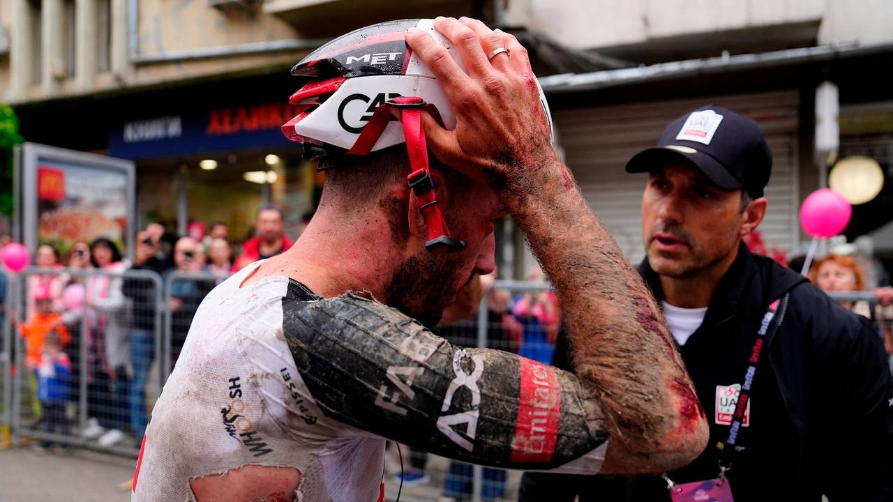 Mitfavorit Adam Yates stürzte beim Giro d'Italia schwer.