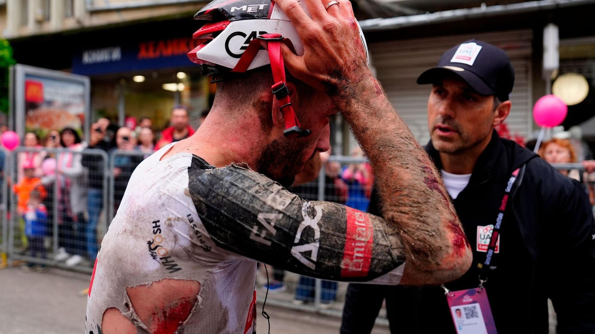 Mitfavorit Adam Yates stürzte beim Giro d'Italia schwer.