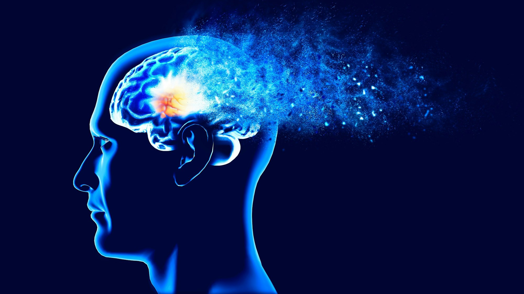 Alzheimer, Demenz, Vergessen, Verfall