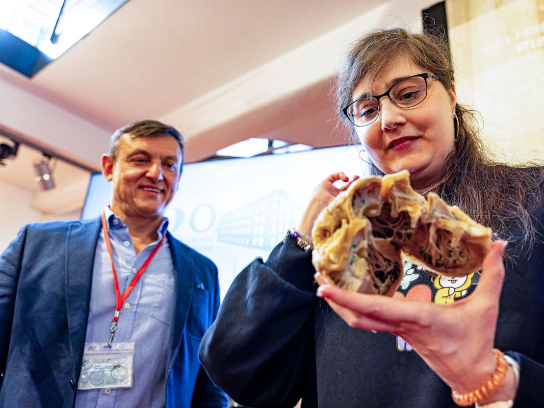 Martina Grabsch hält ihr eigenes, plastiniertes Herz in der Hand
