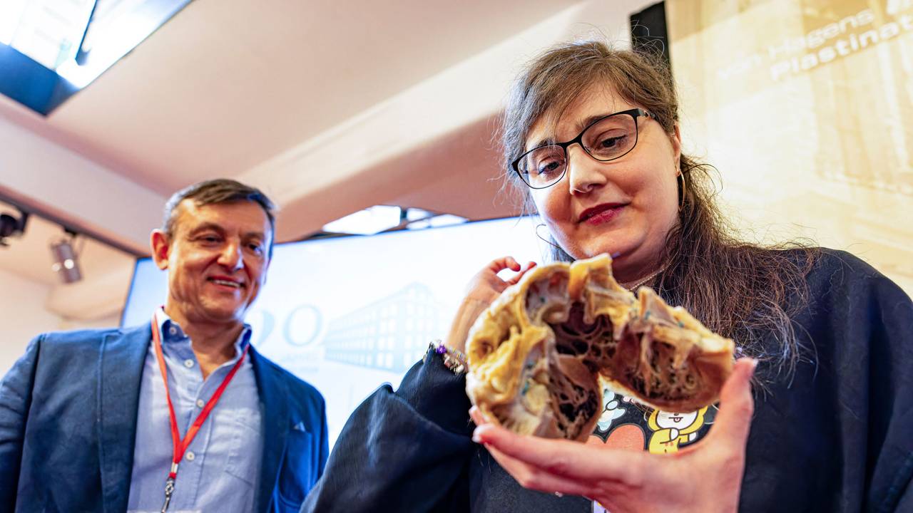Martina Grabsch hält ihr eigenes, plastiniertes Herz in der Hand