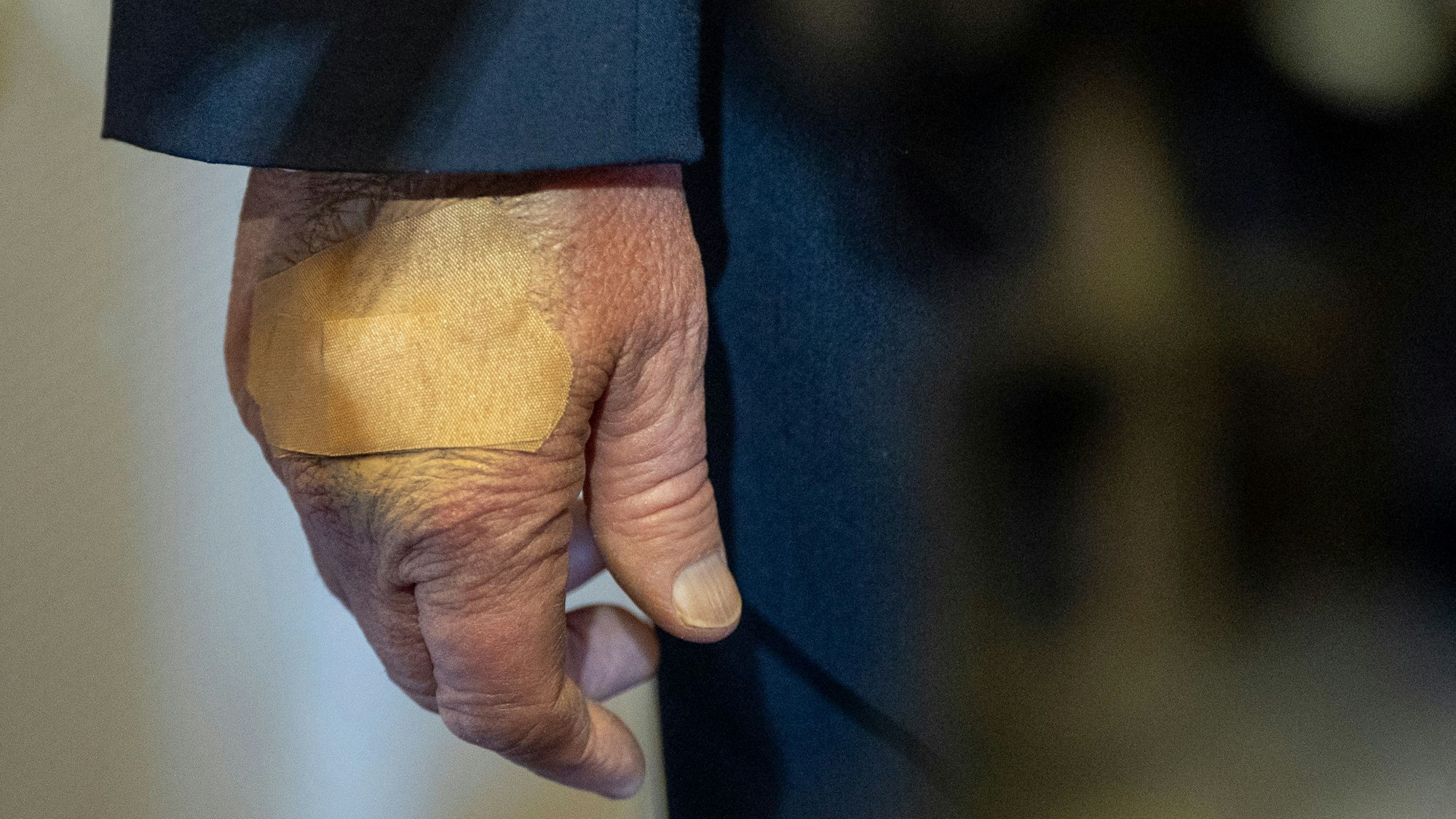 Die rechte Hand von US-Präsident Donald Trump ist bandagiert (Archivbild).