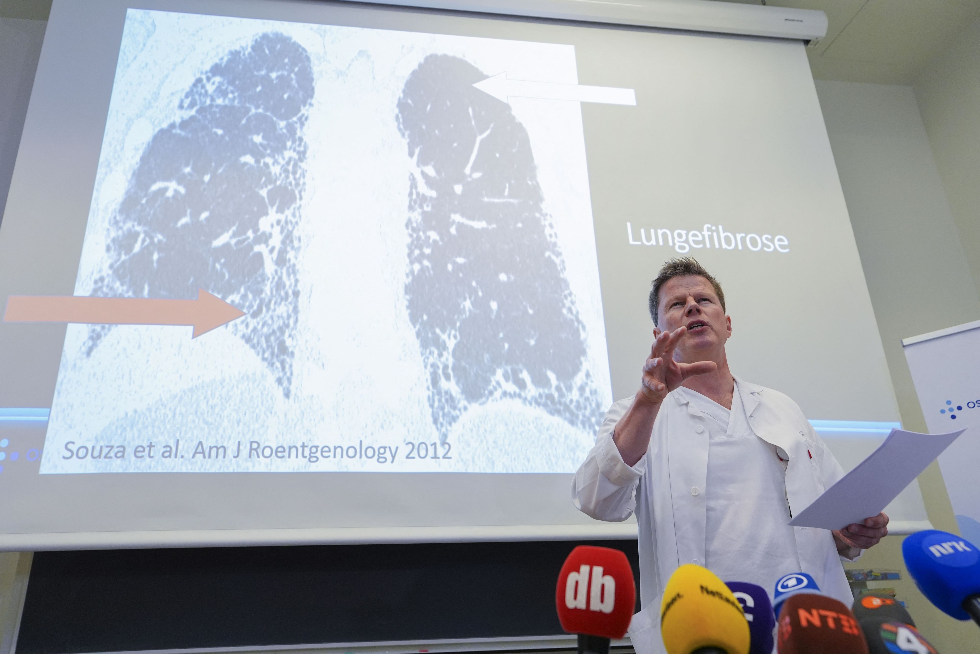 Lungenfacharzt Are Holm steht vor einer Aufnahme, die eine Lungenfibrose zeigt. Er spricht in zahlreiche Mikrofone von Pressevertretern.