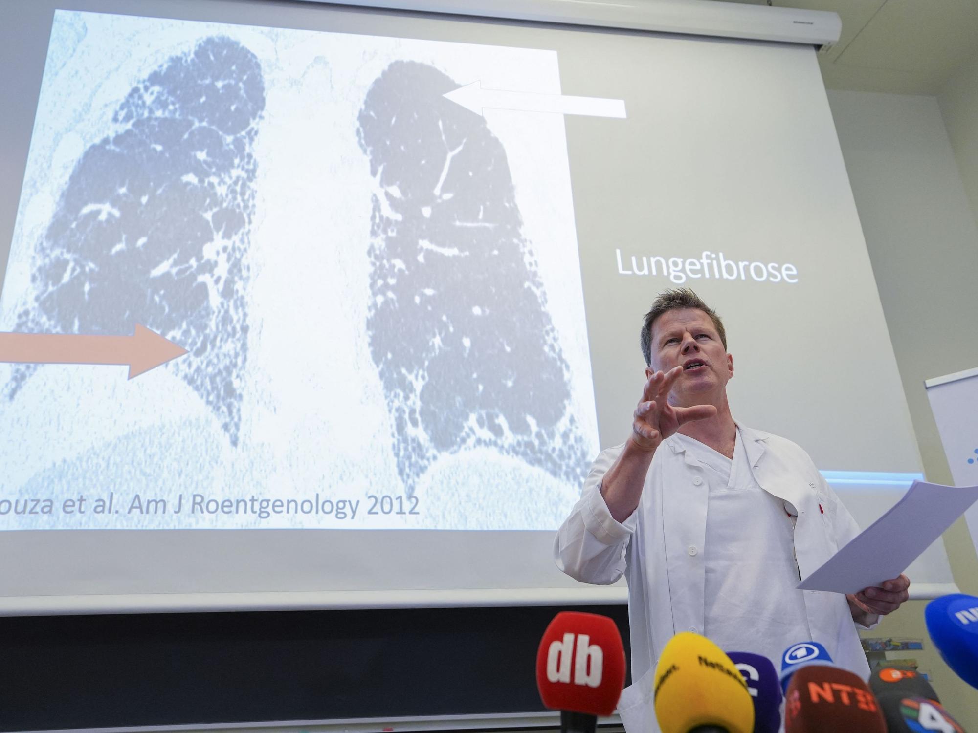 Lungenfacharzt Are Holm steht vor einer Aufnahme, die eine Lungenfibrose zeigt. Er spricht in zahlreiche Mikrofone von Pressevertretern.