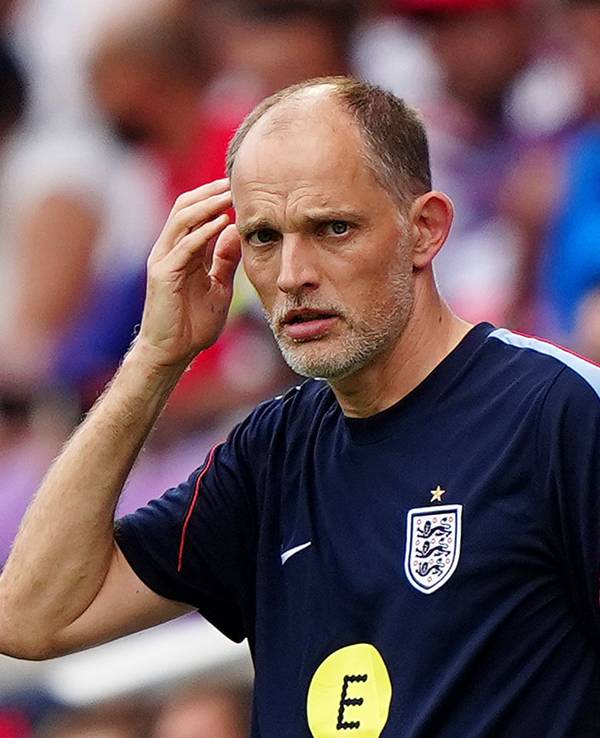 Thomas Tuchel fasst sich an den Kopf.
