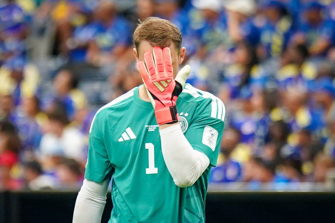 Manuel Neuer hält sich die Hand vor das Gesicht.