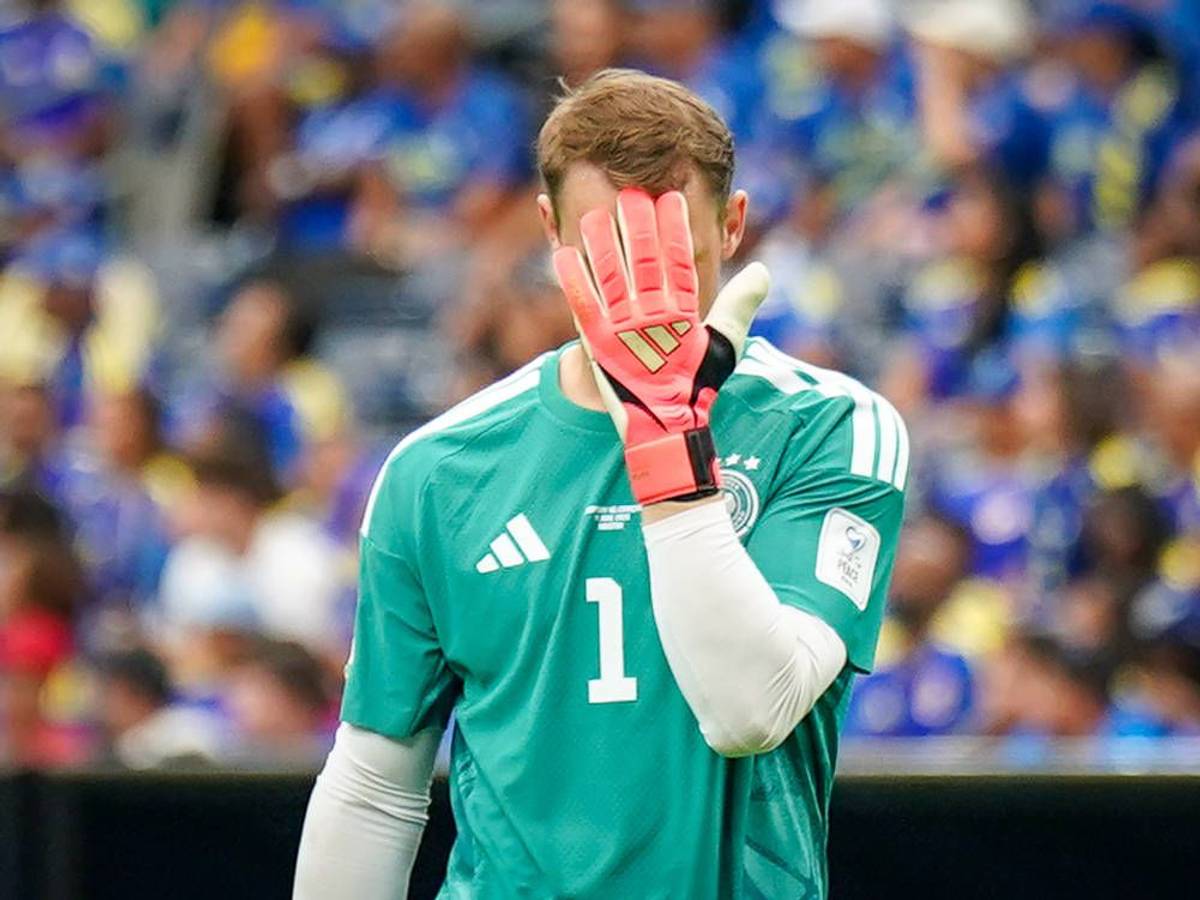 Manuel Neuer hält sich die Hand vor das Gesicht.
