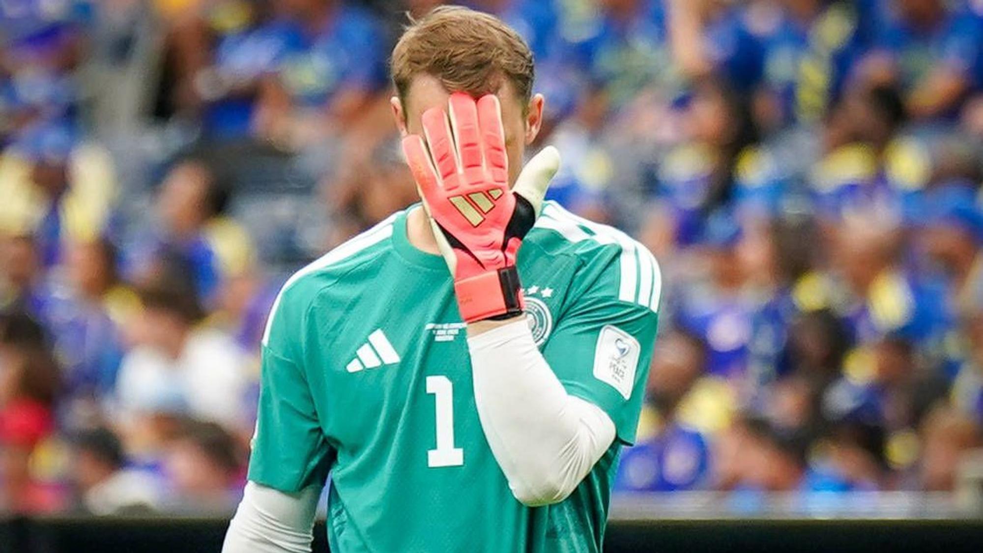 Manuel Neuer hält sich die Hand vor das Gesicht.