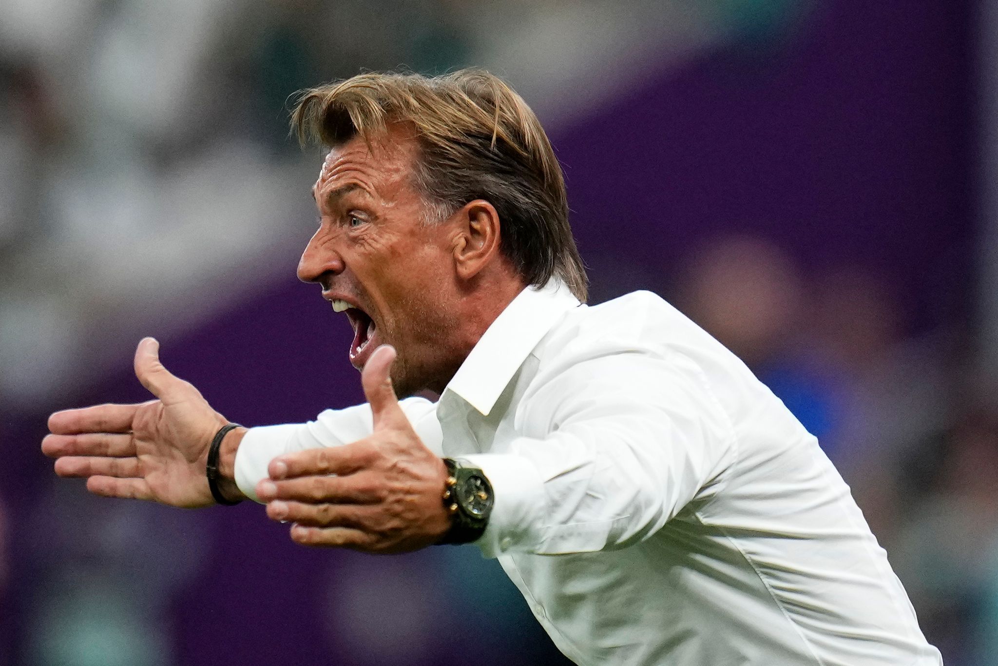 Hervé Renard