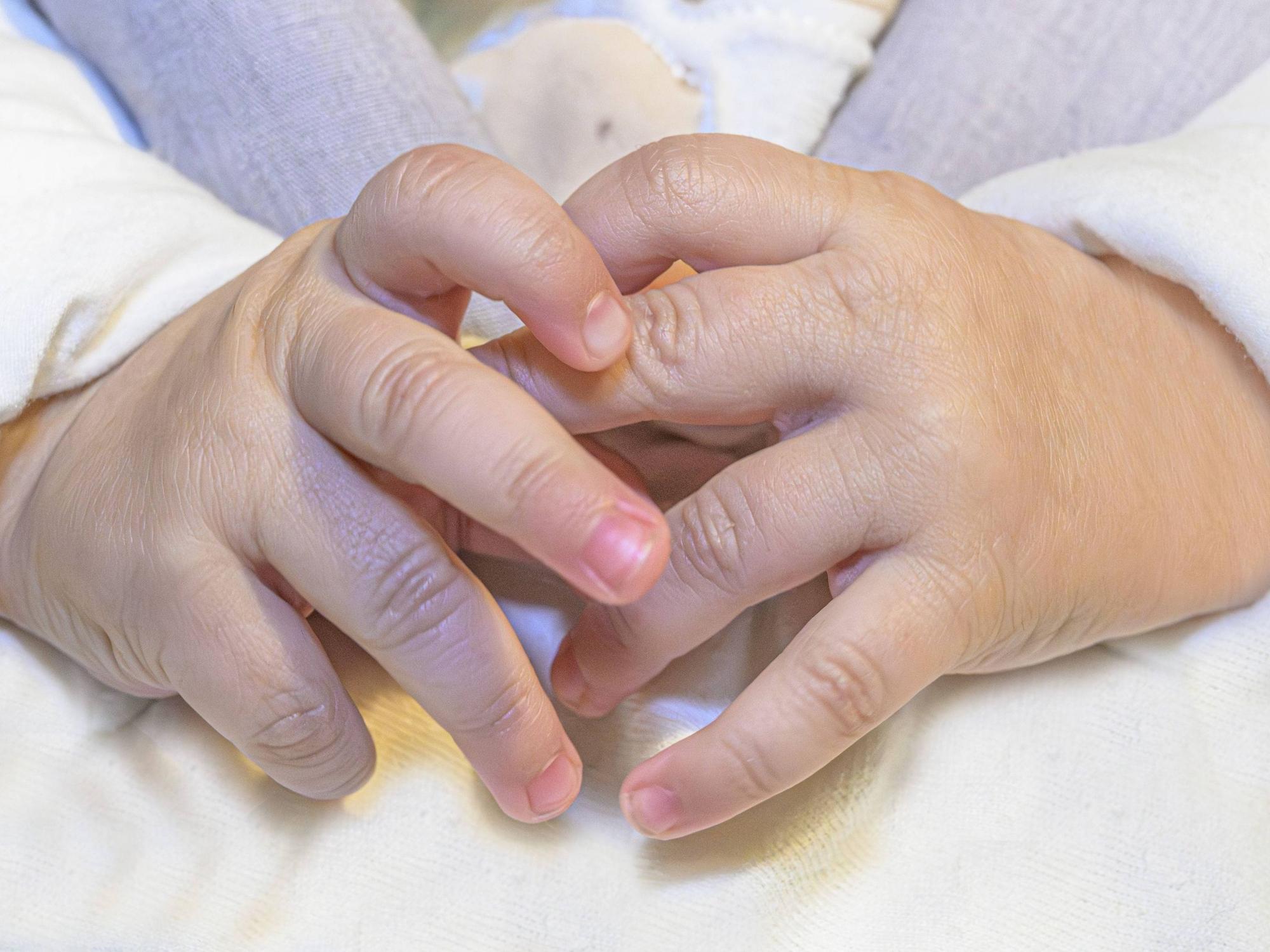 Das Symbolfoto zeigt die Nahaufnahme von Babyhänden. In Lüdenscheid wurde ein Neugeborenes von einer unbekannten Frau aus einem Krankenhaus mitgenommen.