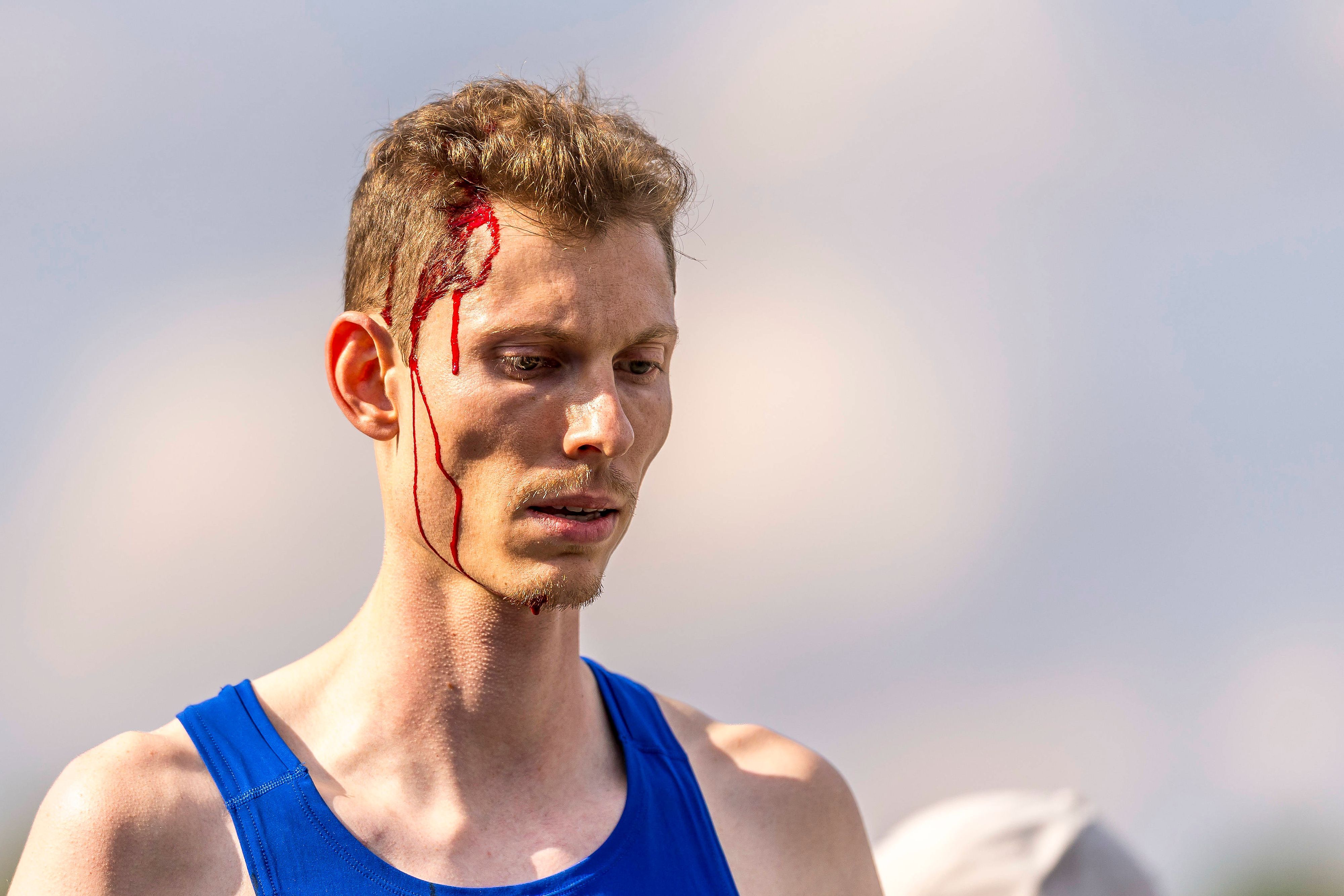 Tobias Potye mit Blut am Kopf und im Gesicht.