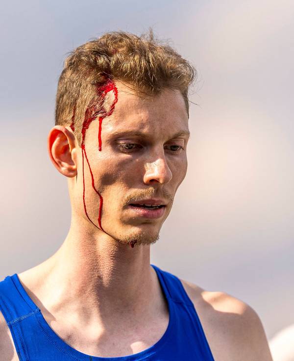 Tobias Potye mit Blut am Kopf und im Gesicht.