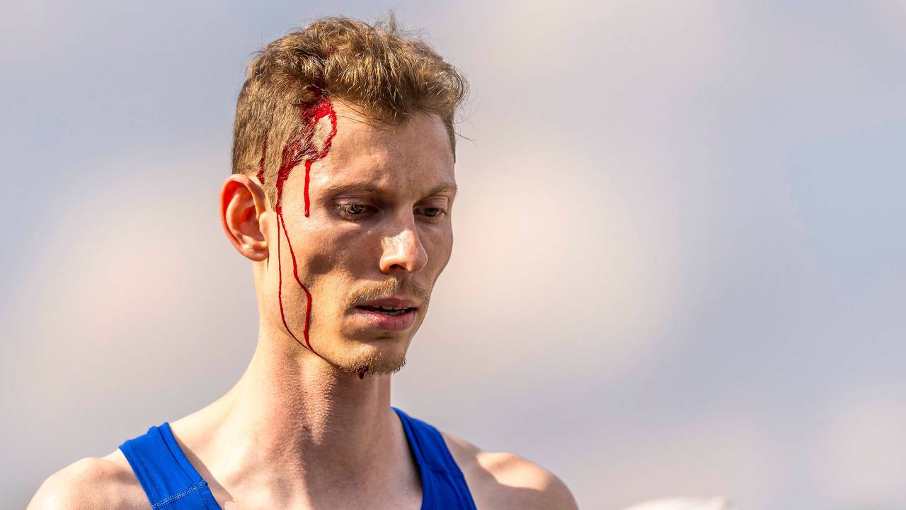 Tobias Potye mit Blut am Kopf und im Gesicht.