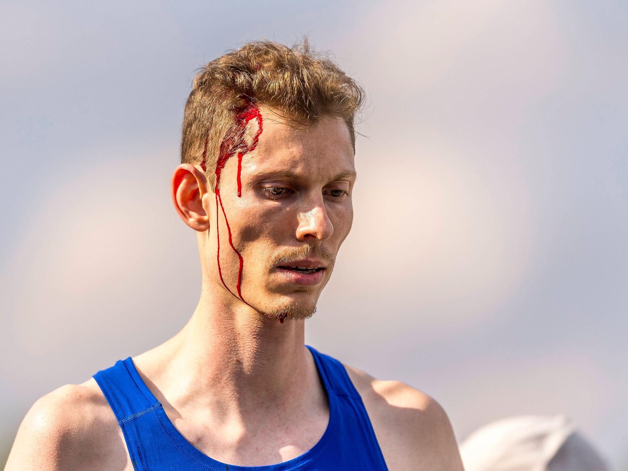 Tobias Potye mit Blut am Kopf und im Gesicht.