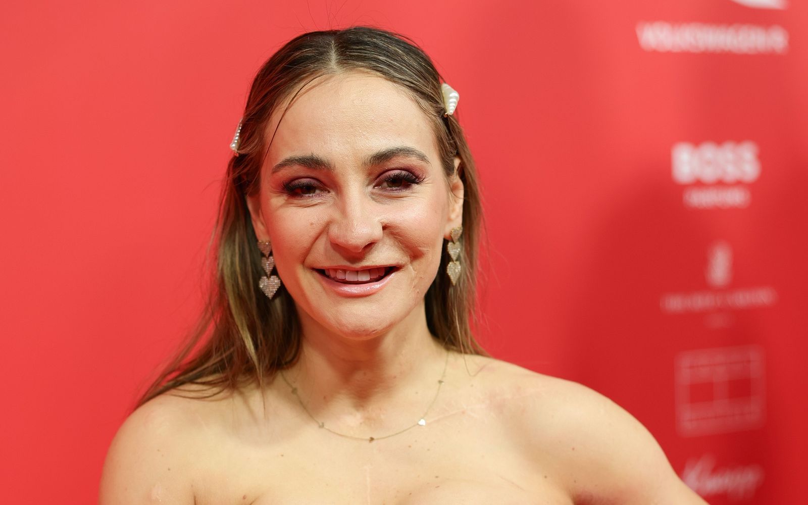 In einem Podcast spricht die ehemalige Leistungssportlerin Kristina Vogel über den Umgang mit ihren Narben. (Bild: 2025 Getty Images/Andreas Rentz)