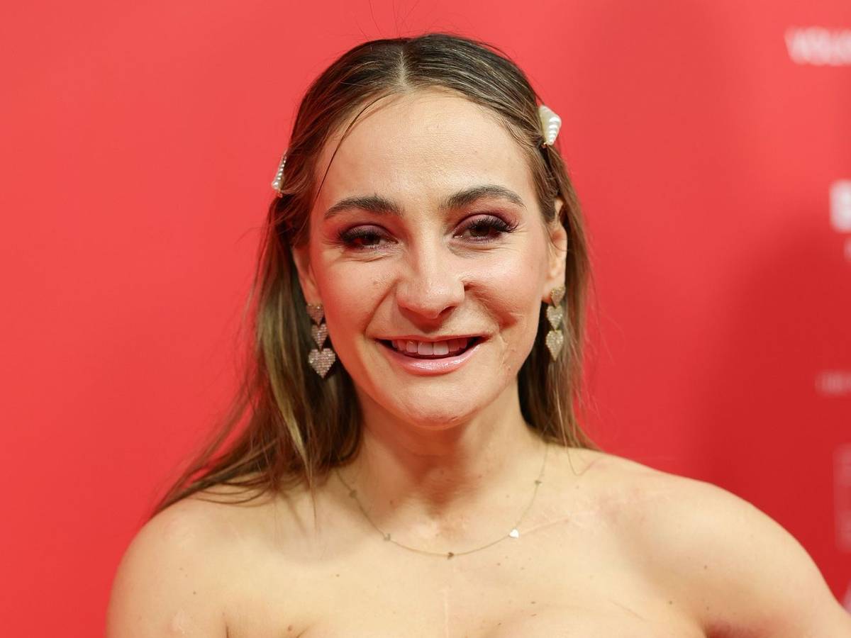 In einem Podcast spricht die ehemalige Leistungssportlerin Kristina Vogel über den Umgang mit ihren Narben. (Bild: 2025 Getty Images/Andreas Rentz)