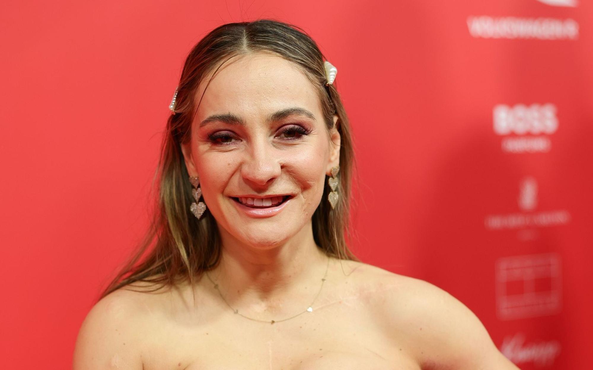 In einem Podcast spricht die ehemalige Leistungssportlerin Kristina Vogel über den Umgang mit ihren Narben. (Bild: 2025 Getty Images/Andreas Rentz)