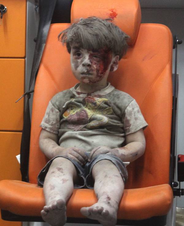 Der damals fünfjährige Omran Daqneesh sitzt am 17. August 2016 verletzt im Krankenwagen nach einem Luftangriff auf den Stadtteil Qaterji in Aleppo.