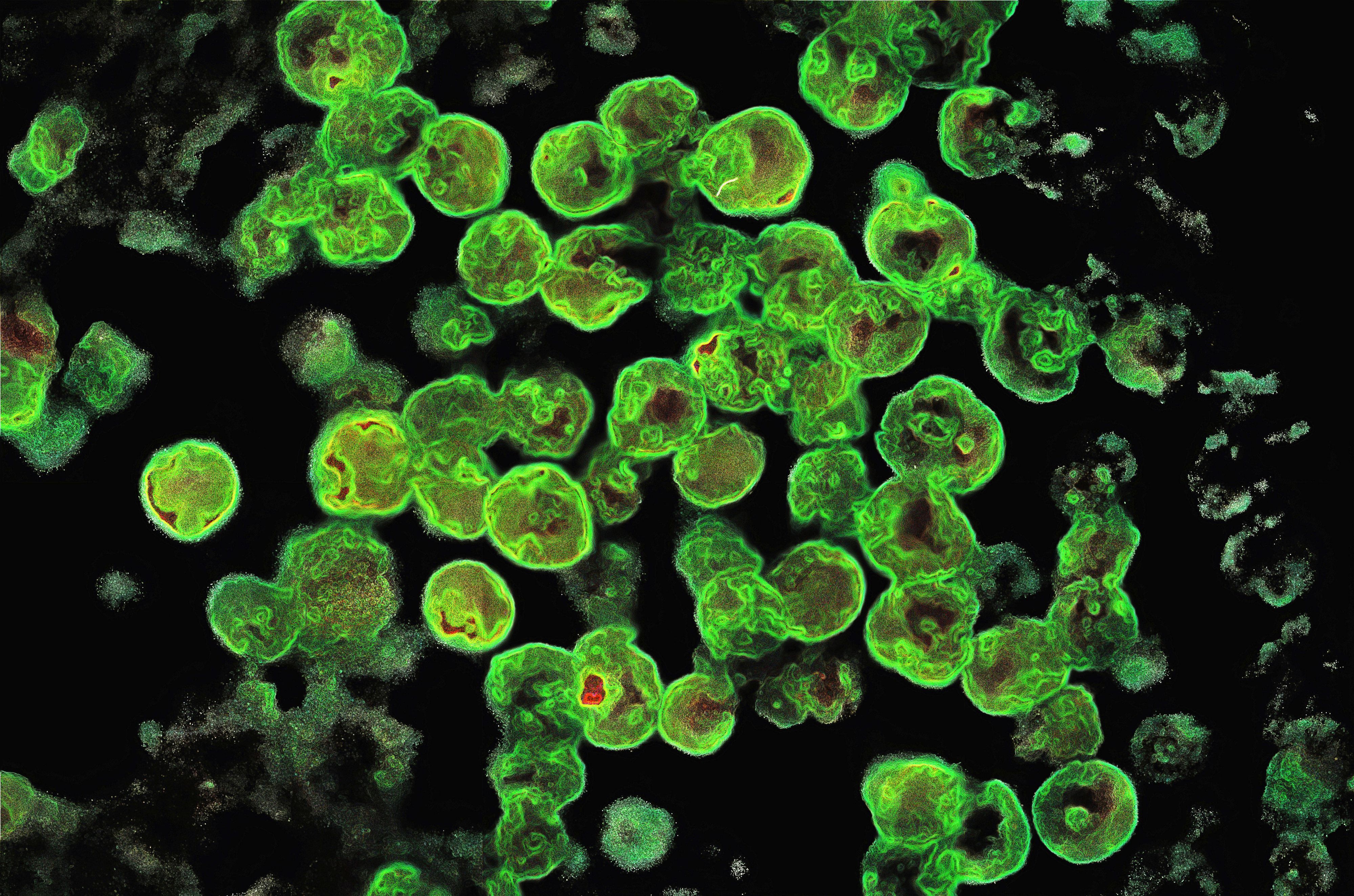 Naegleria fowleri unter dem Mikroskop (Archiv)