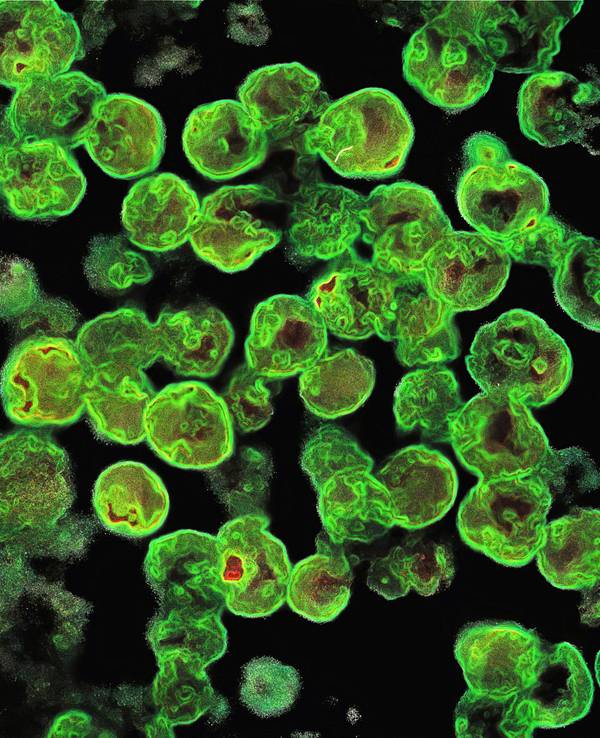 Naegleria fowleri unter dem Mikroskop (Archiv)