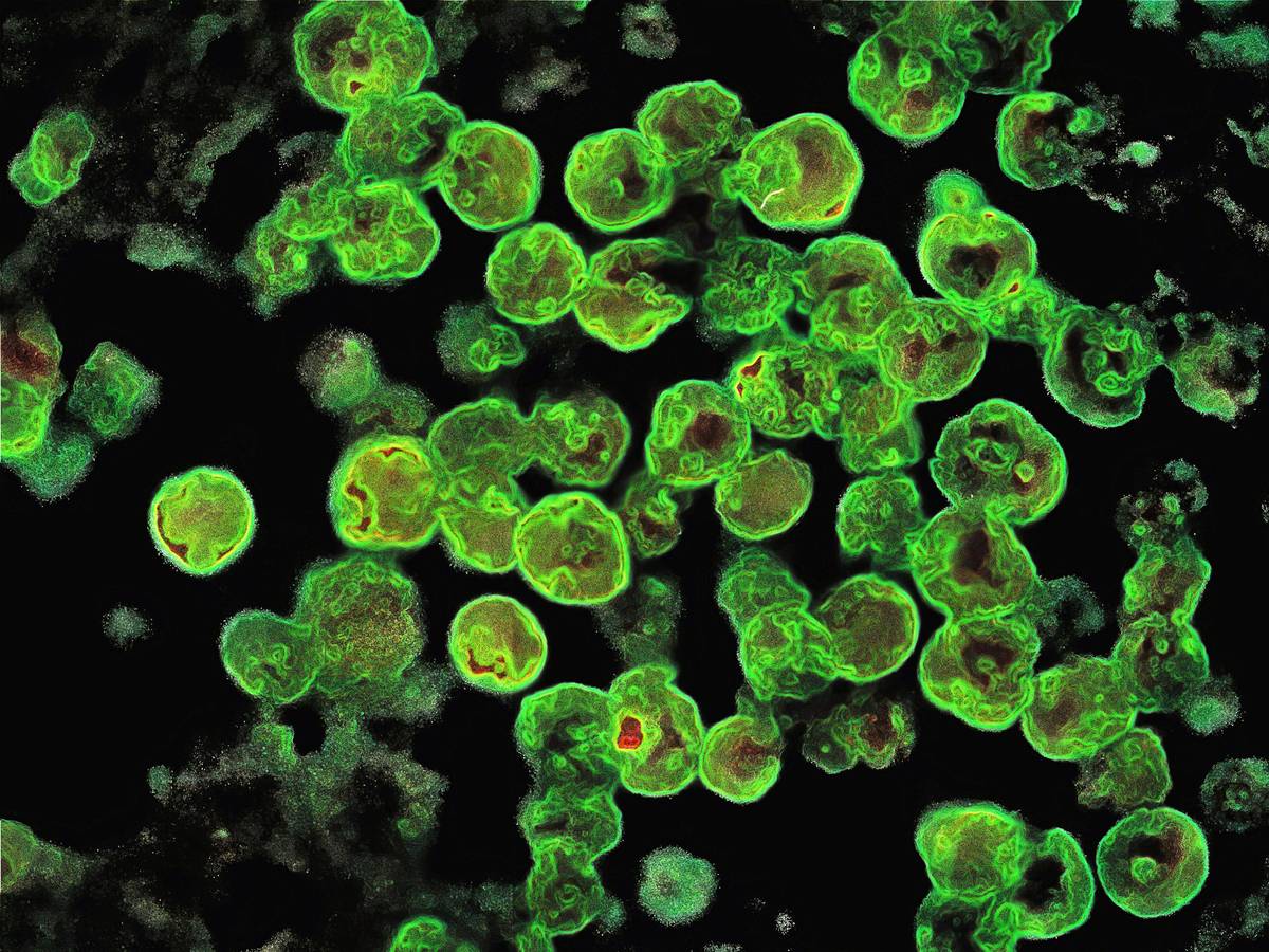 Naegleria fowleri unter dem Mikroskop (Archiv)