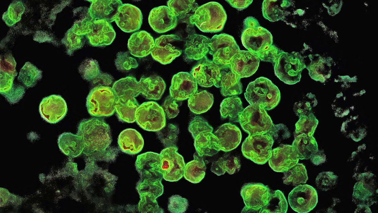 Naegleria fowleri unter dem Mikroskop (Archiv)