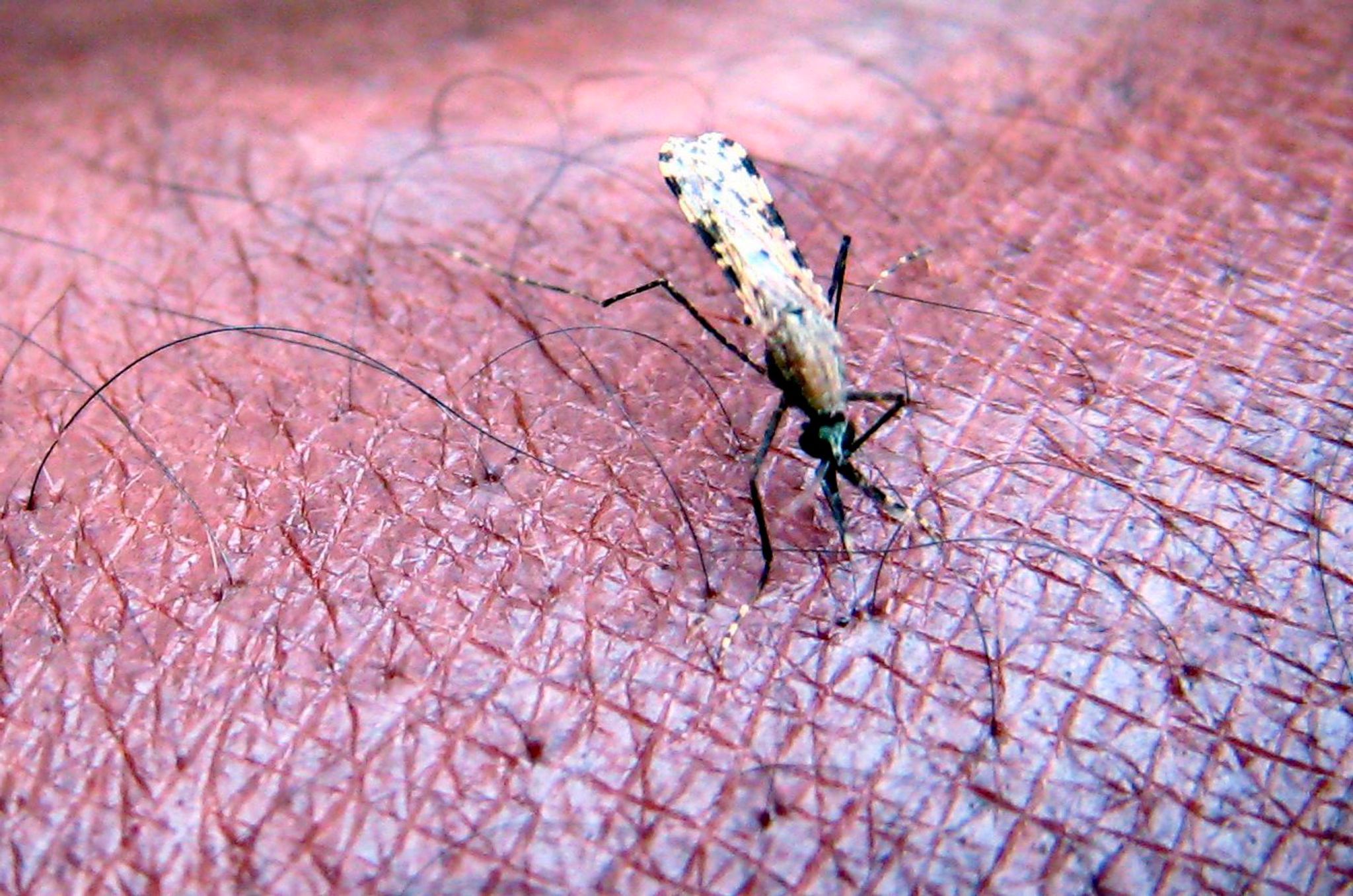 Malaria